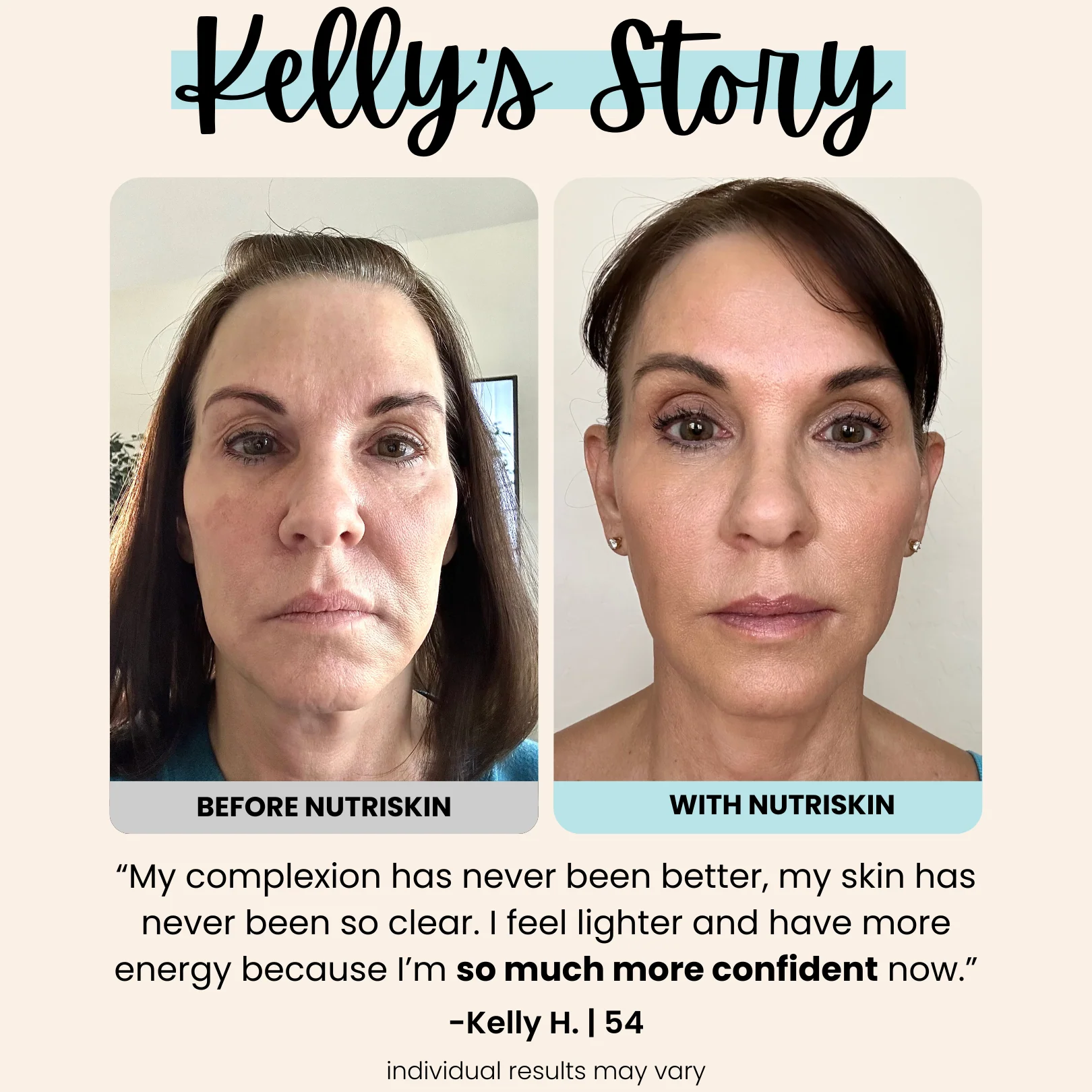 Nutriskin LED Face Mask - Red Light Therapy for Wrinkles + FREE Neck Mask ($169 Value)