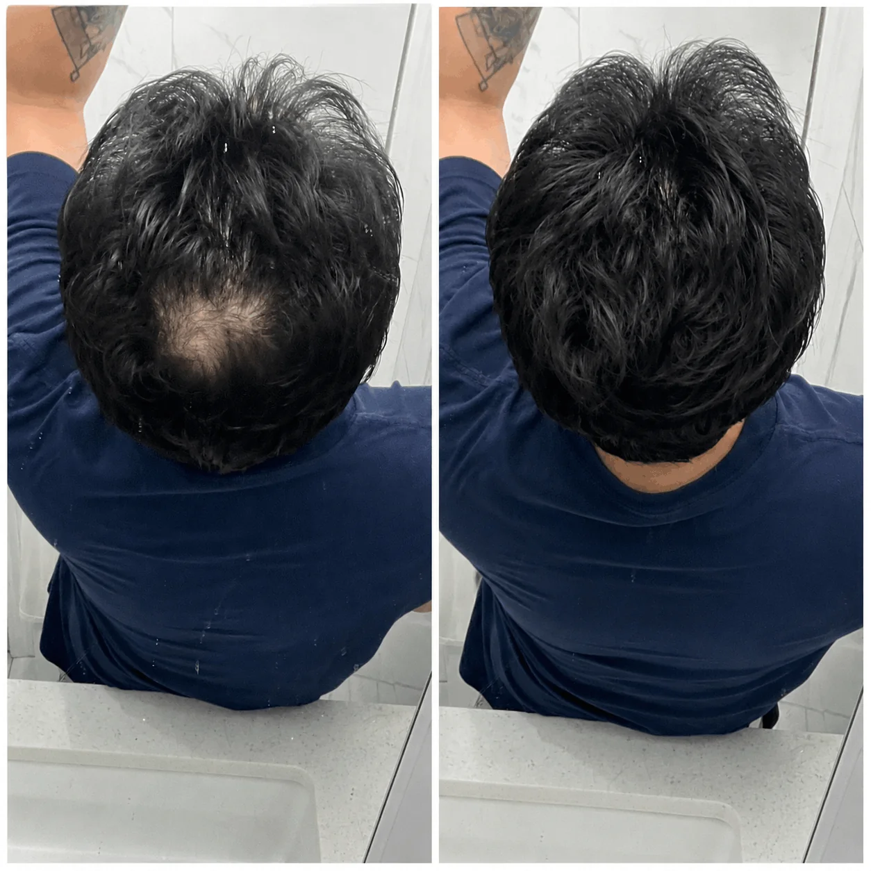 DENSIQ Pro - Instant Hair Density Filler 