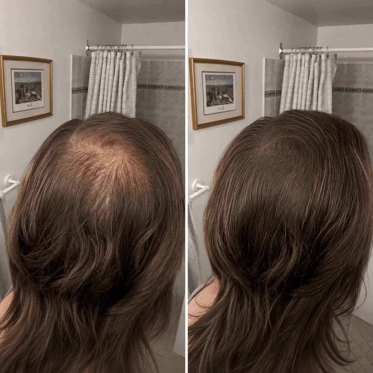 DENSIQ Pro - Instant Hair Density Filler 