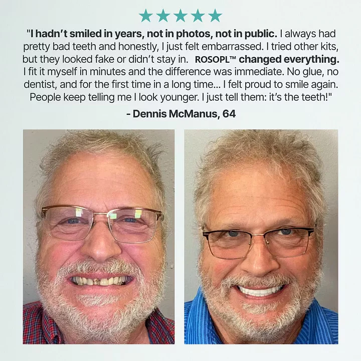 Cheeroll®Custom-Fit Dentures ⏰ ENDS TODAY • 70% OFF | Smile with Confidence