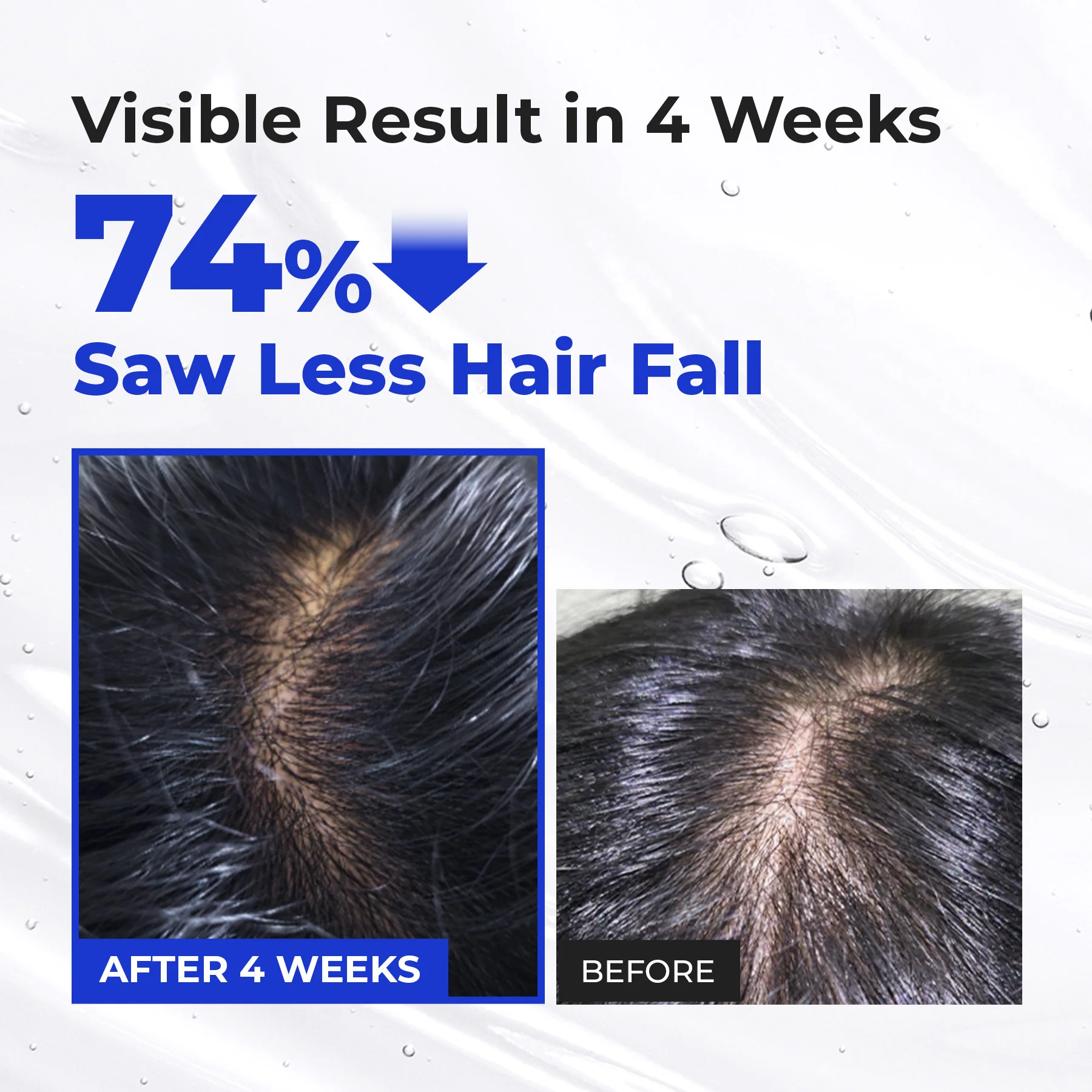 Scalp Boosting Hair Serum