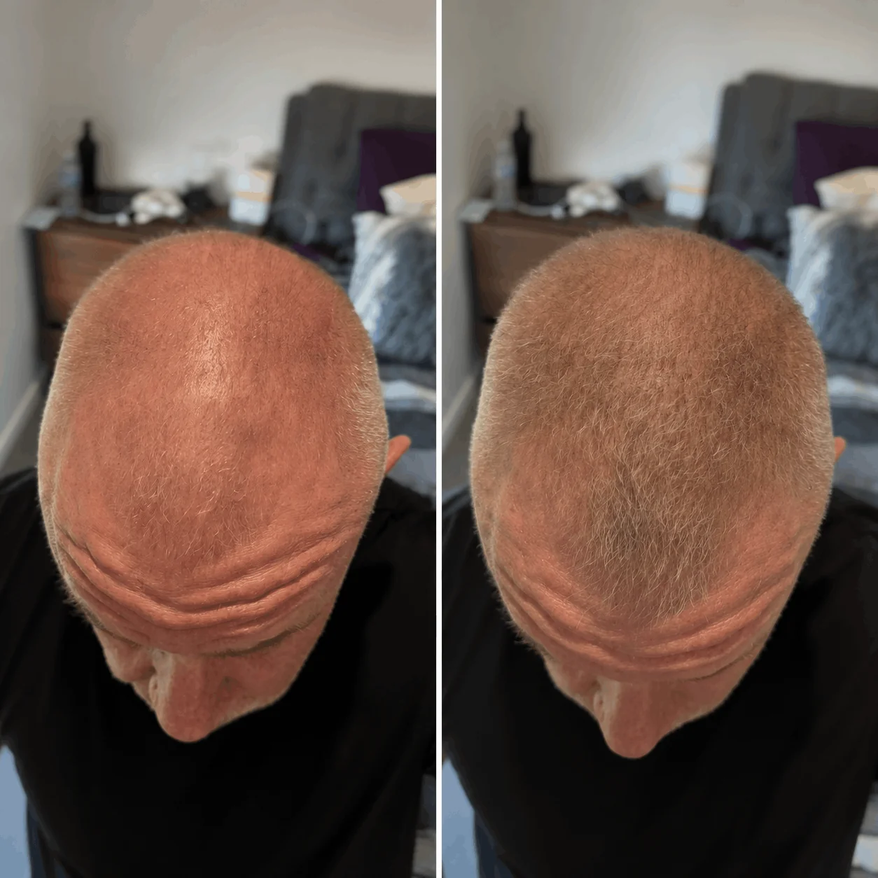 DENSIQ Pro - Instant Hair Density Filler 