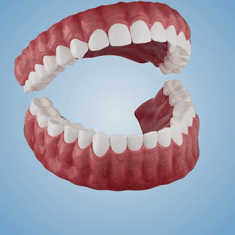 🔥Ends Today: 70% OFF!(Affordable Beauty🧏‍♀️🧏‍♂️)--Tiworld™ --Advanced Customized Full Denture Set🦷