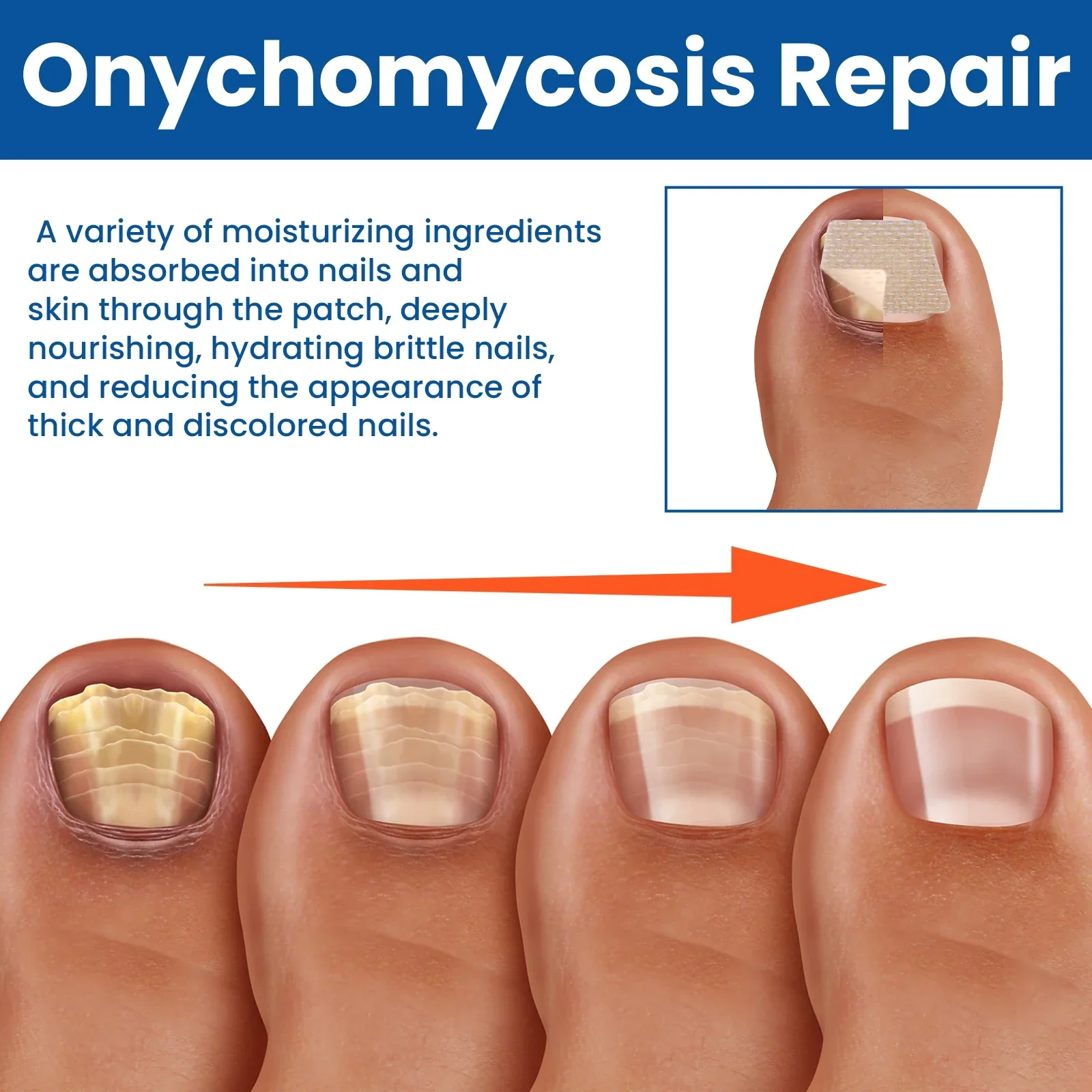 Fungus Nail Repair Patches