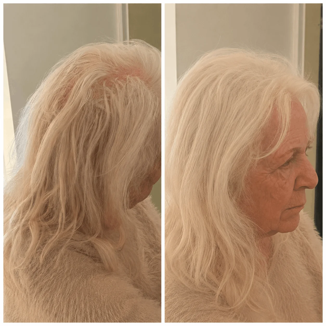 DENSIQ Pro - Instant Hair Density Filler 