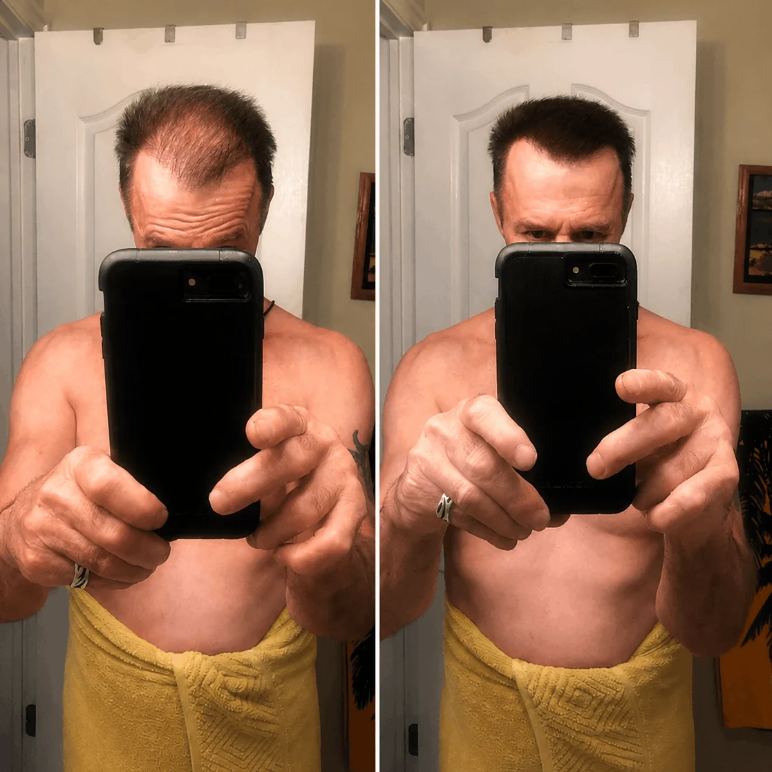 DENSIQ Pro - Instant Hair Density Filler 