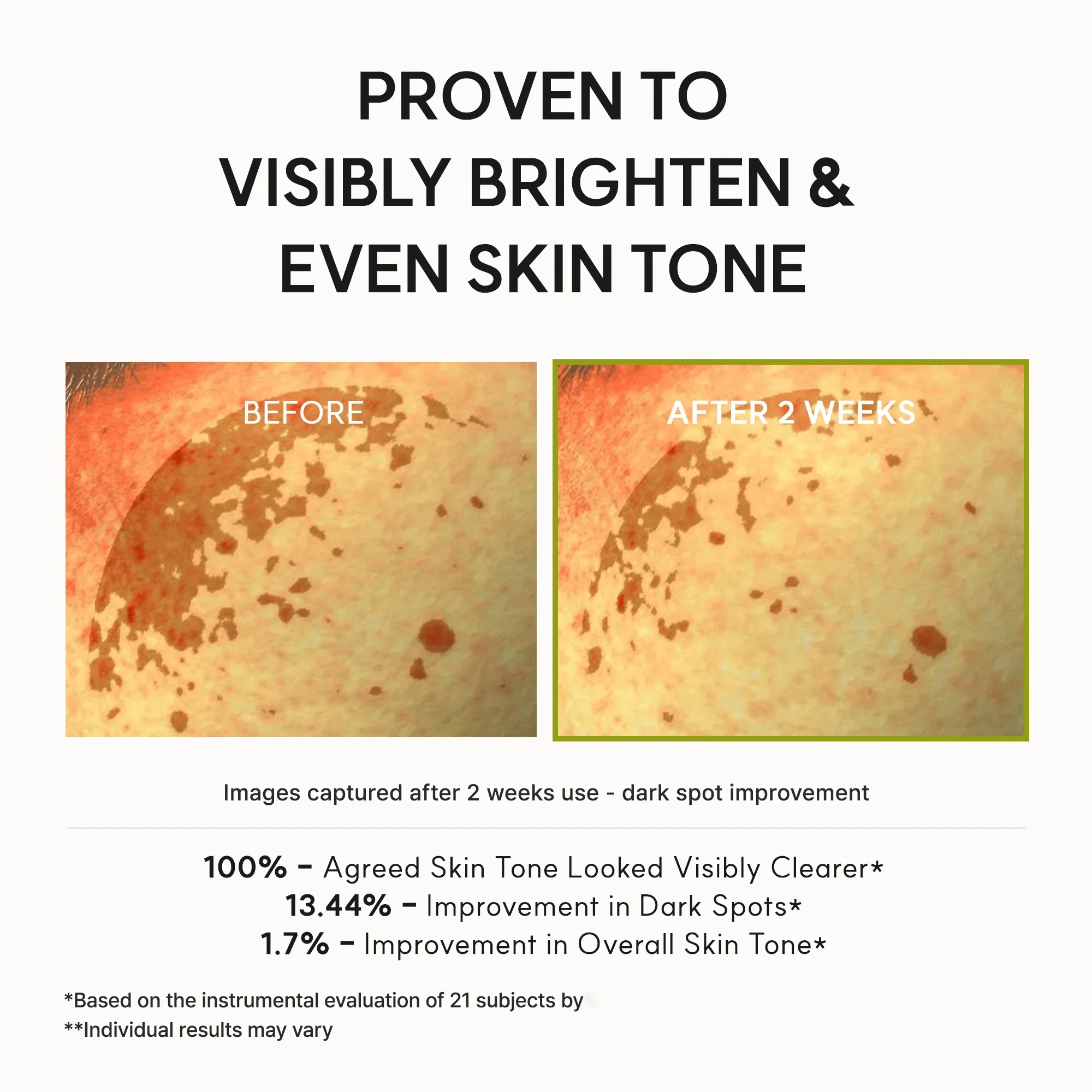 Clezyra Vitamin C Booster Shot