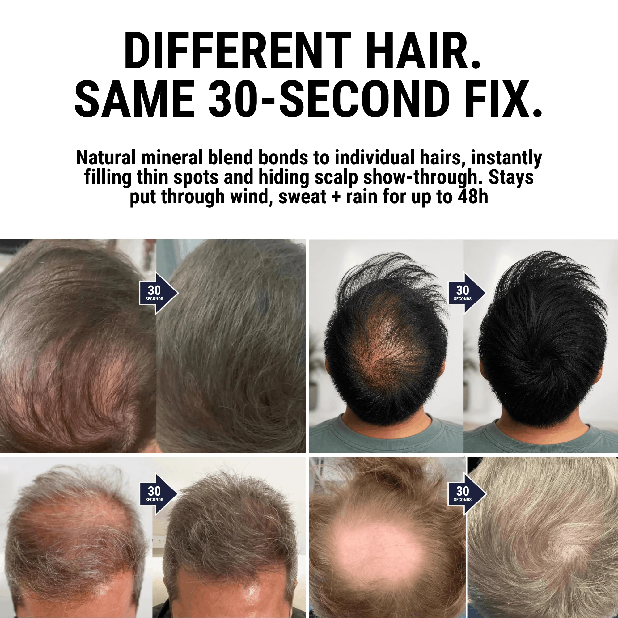 DENSIQ Pro - Instant Hair Density Filler 