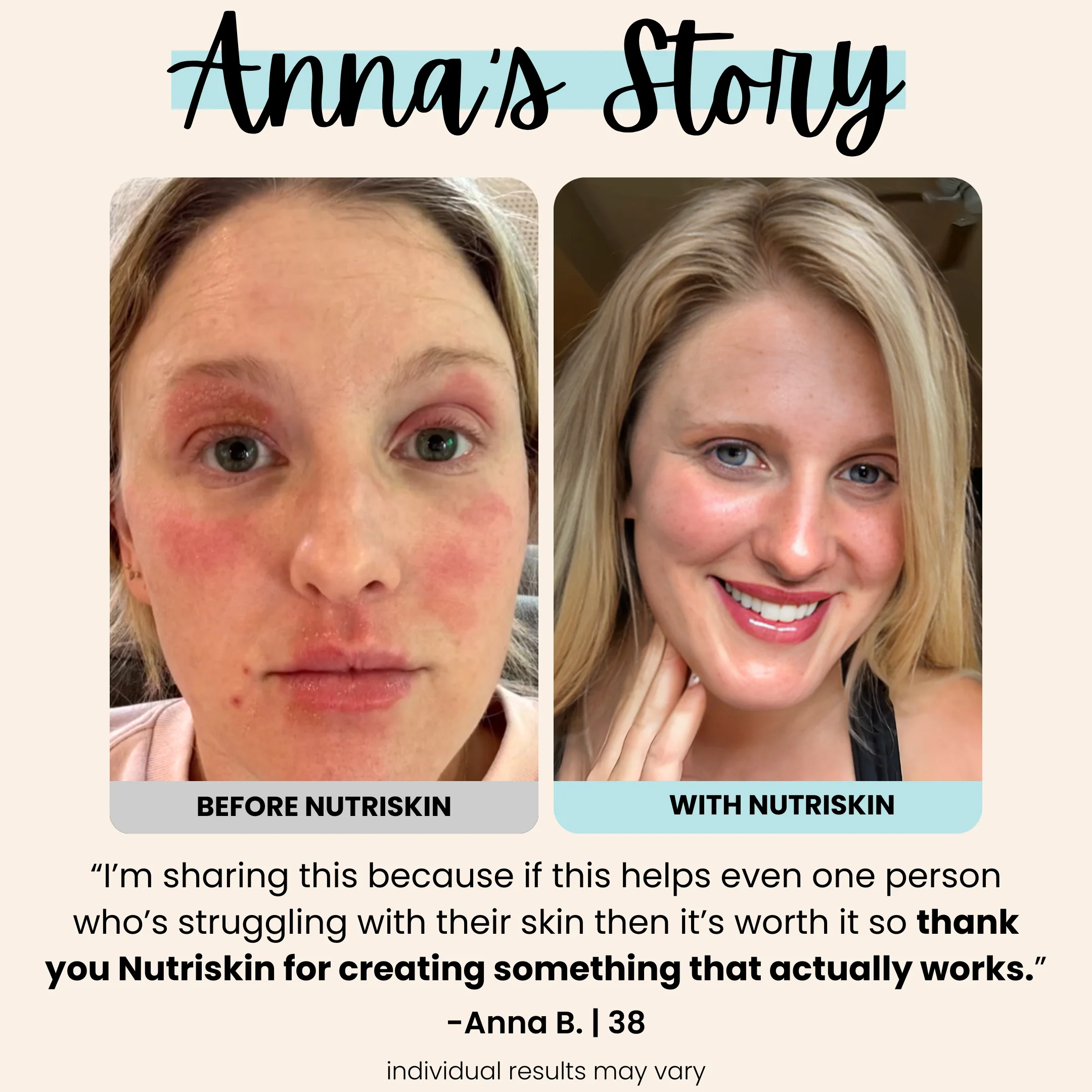 Nutriskin LED Face Mask - Red Light Therapy for Wrinkles + FREE Neck Mask ($169 Value)